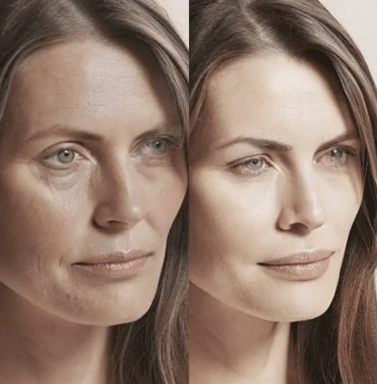 Before and after skin rejuvenation: brighter tone and texture